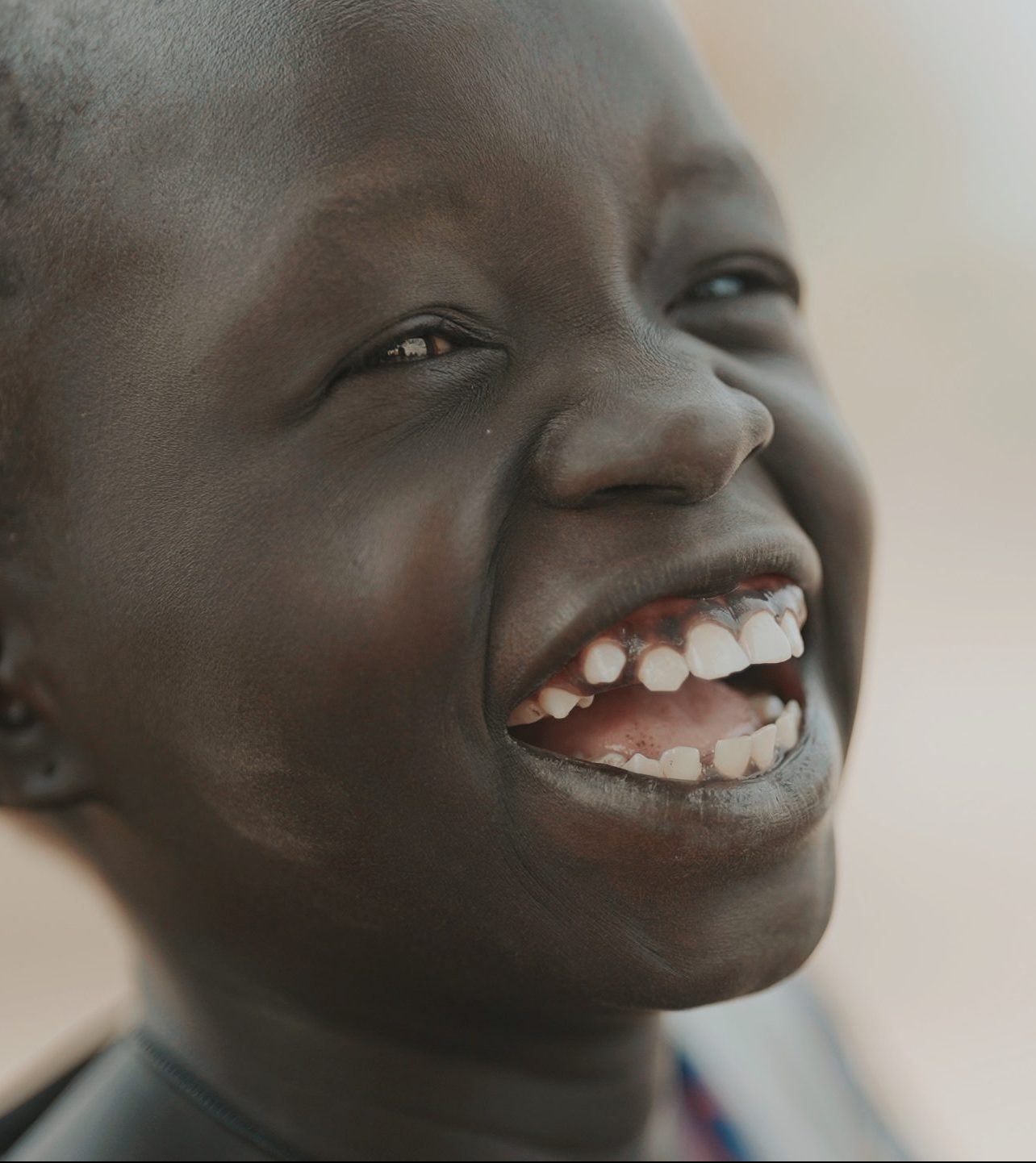 ‘They would call me one leg’